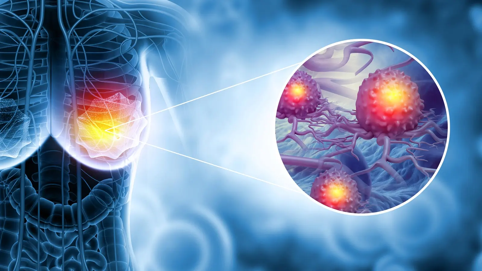 Scientists uncover weakness stopping triple-negative spread