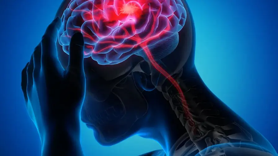 New AI Reads DNA to Predict Ischemic Stroke Risk Accurately